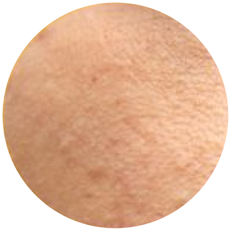 Lumina-Medspa-skin-3