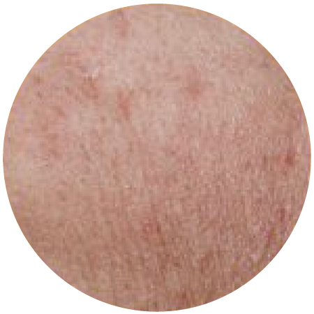 Lumina-Medspa-skin-5