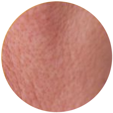 Lumina-Medspa-skin-6